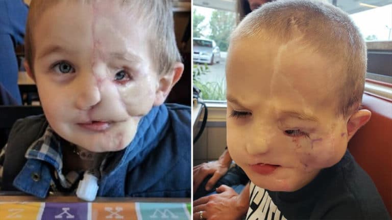 5‑Year‑Old Boy Survives Dog Attack, Faces Cruel Bullying
